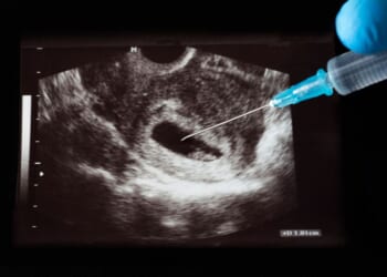 A doctor holds a syringe in front of an x-ray of a preborn child.