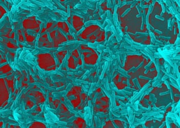 Gut bacteria may flag Parkinson’s disease risk years before symptoms appear