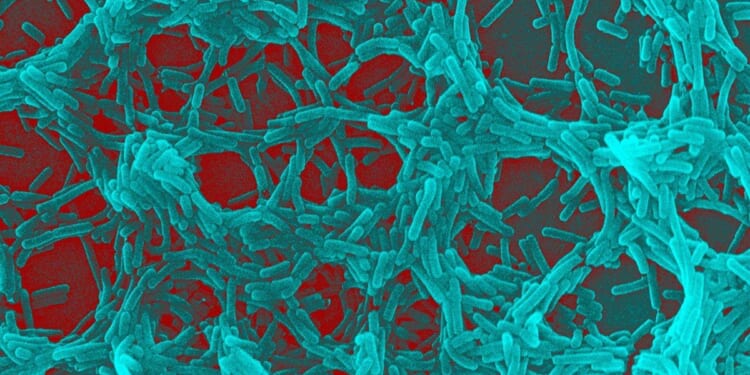 Gut bacteria may flag Parkinson’s disease risk years before symptoms appear