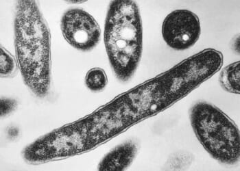 Second death reported in Legionnaires’ disease outbreak in New York City