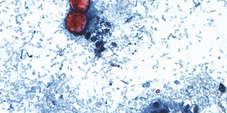 Cyclospora fears force lettuce farmers to plow fields under