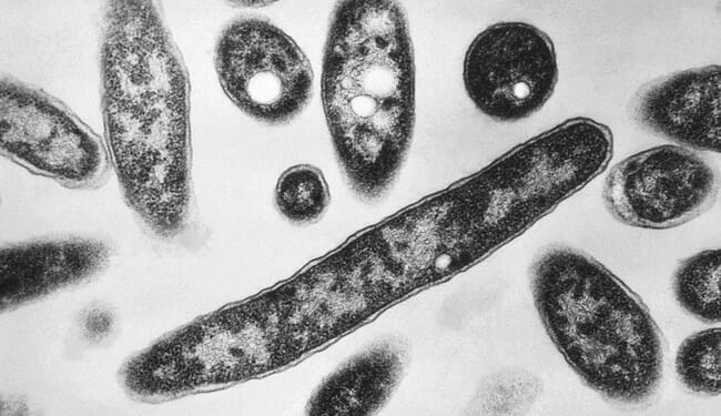 Not Again! Lab-Originated Plague Outbreak in Siberia – HotAir